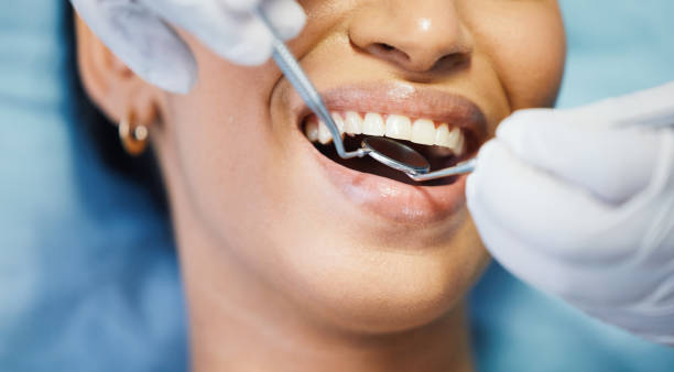 Best Broken or Cracked Tooth Emergency Dentist in Port Gibson, MS